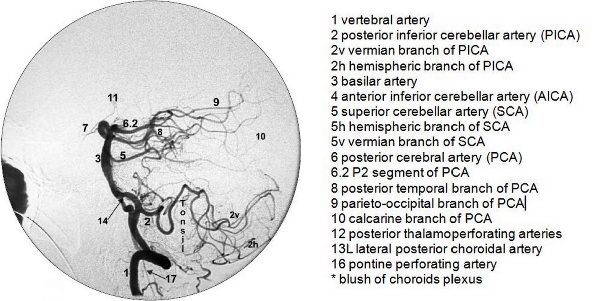 Vertebrobasilar normal anatomy (DSA)